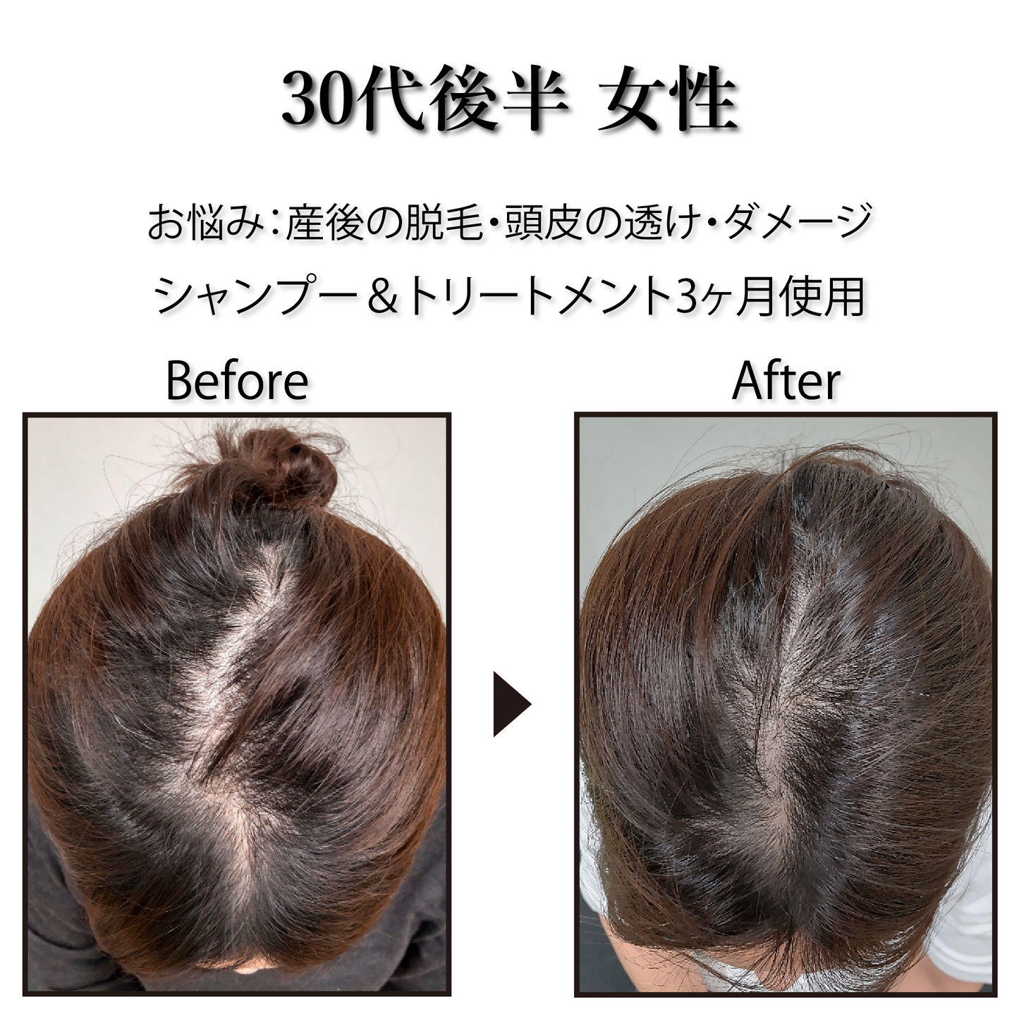 [Pro. Zero+] Revitalize Treatment
