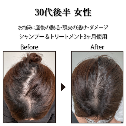 [Pro. Zero+] Revitalize Treatment
