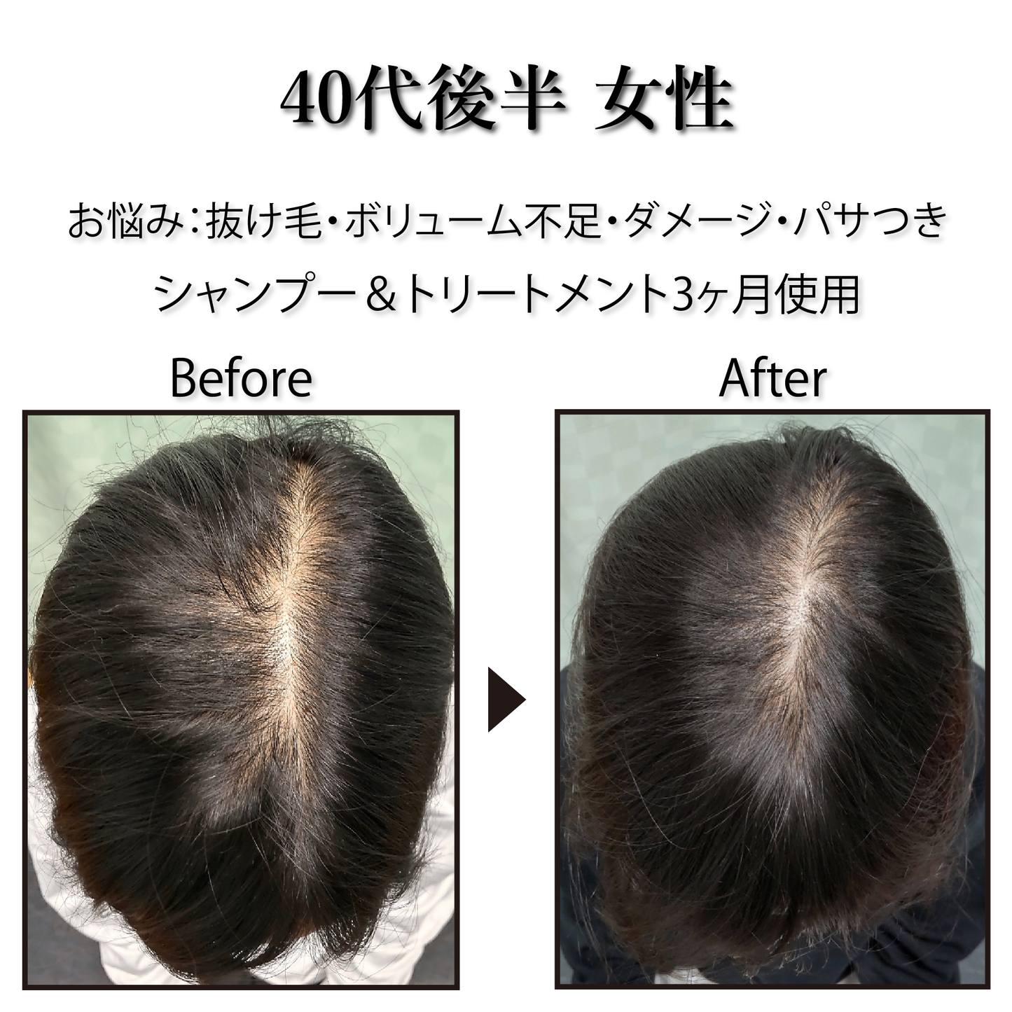 [Pro. Zero+] Revitalize Treatment