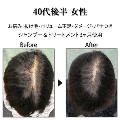 [Pro. Zero+] Revitalize Treatment