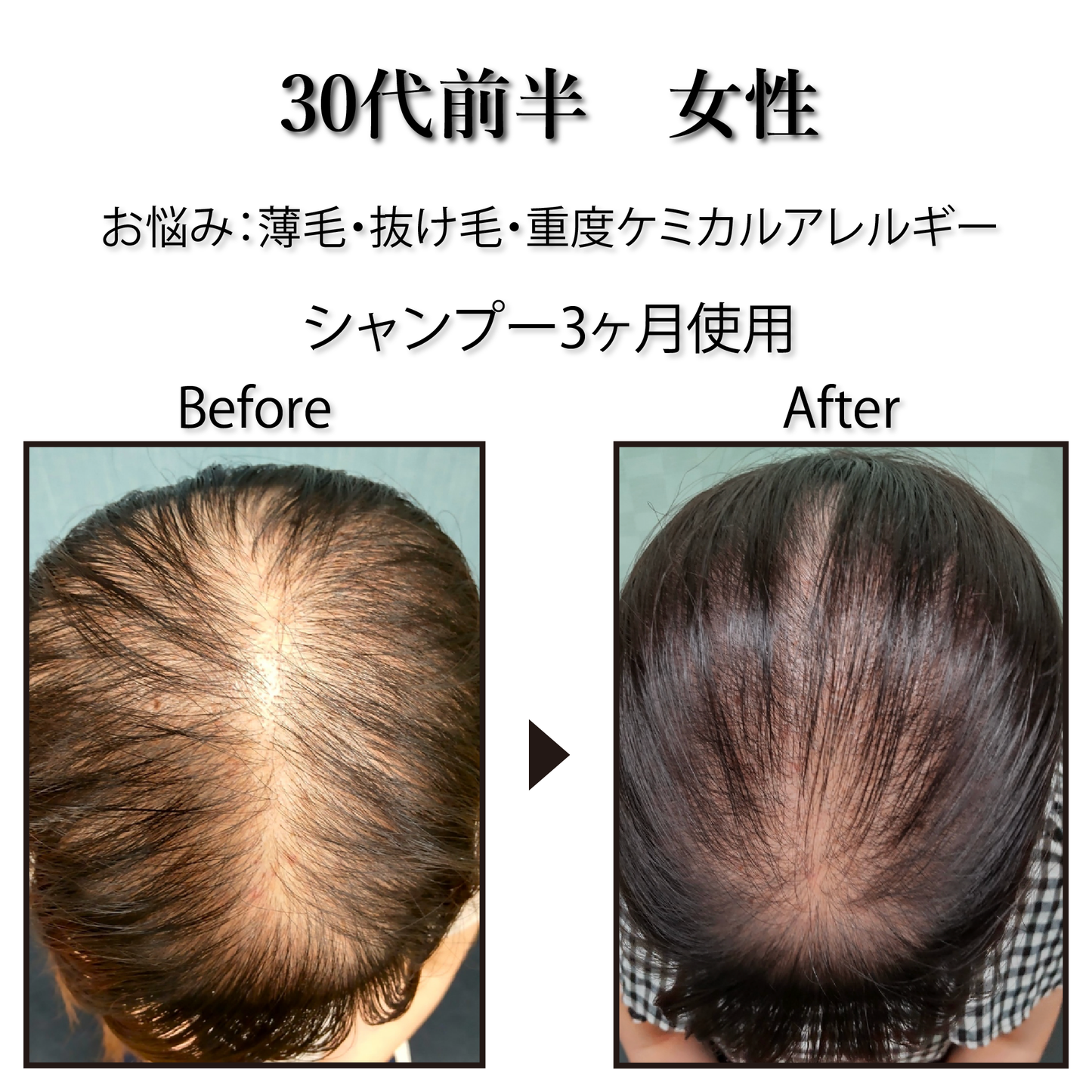 [Pro. Zero] Vital Herb Shampoo