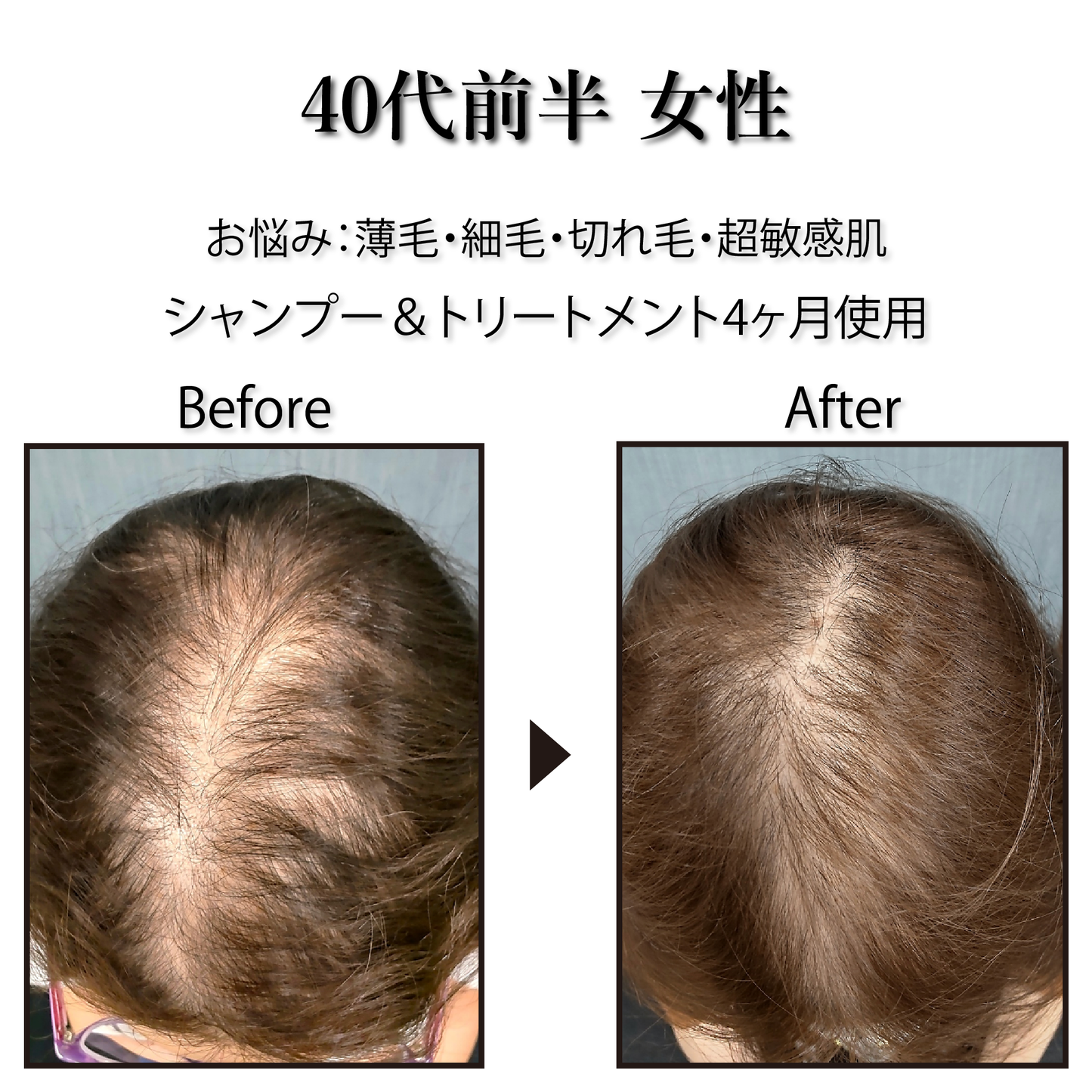 [Pro. Zero+] Revitalize Treatment