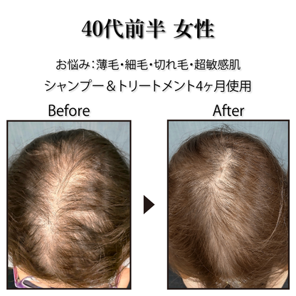 [Pro. Zero+] Revitalize Treatment