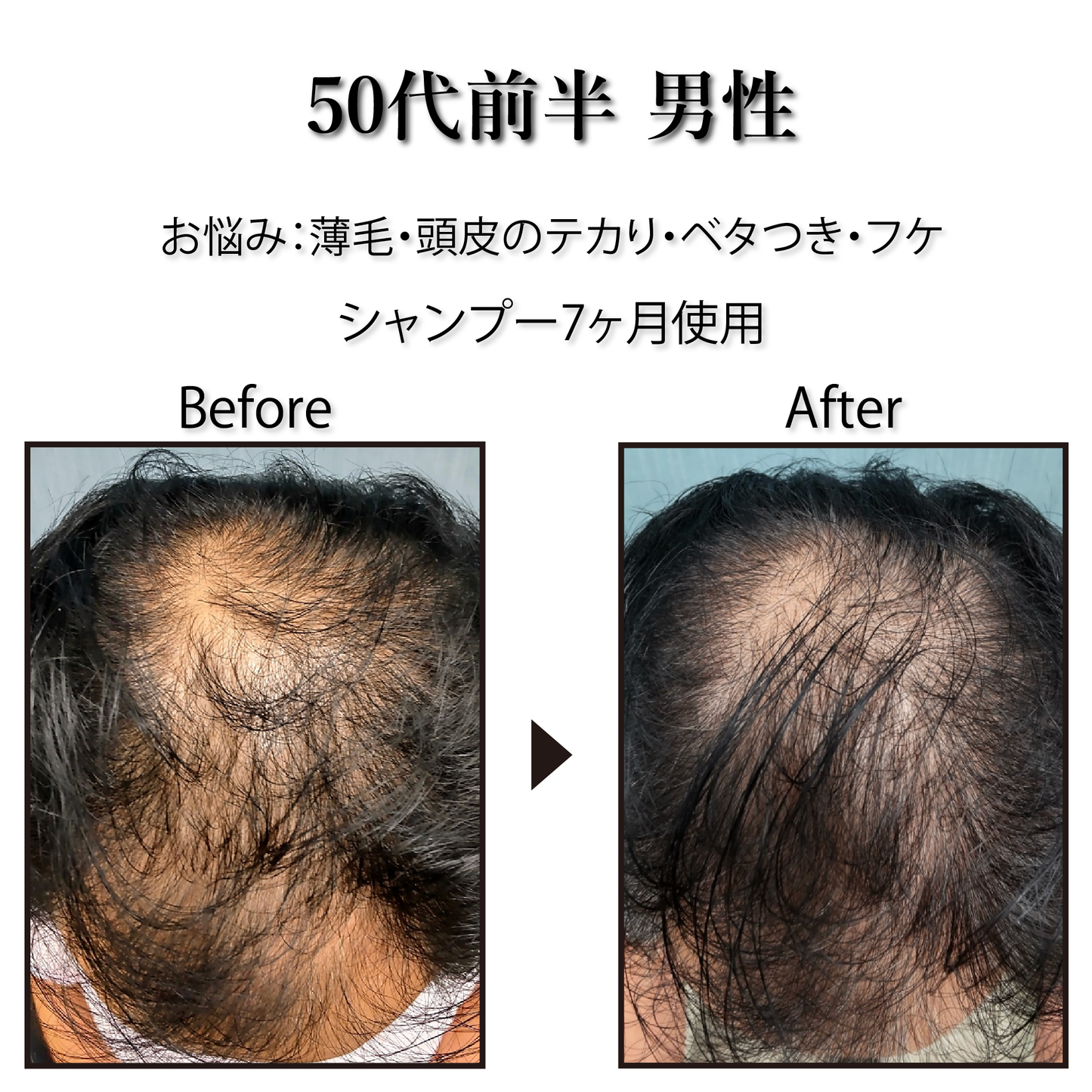 [Pro. Zero] Vital Herb Shampoo