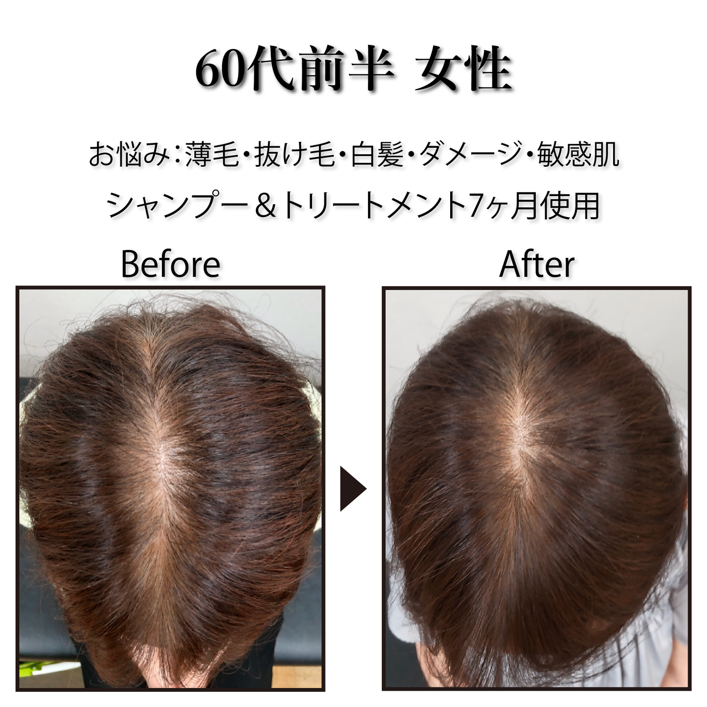[Pro. Zero+] Revitalize Treatment