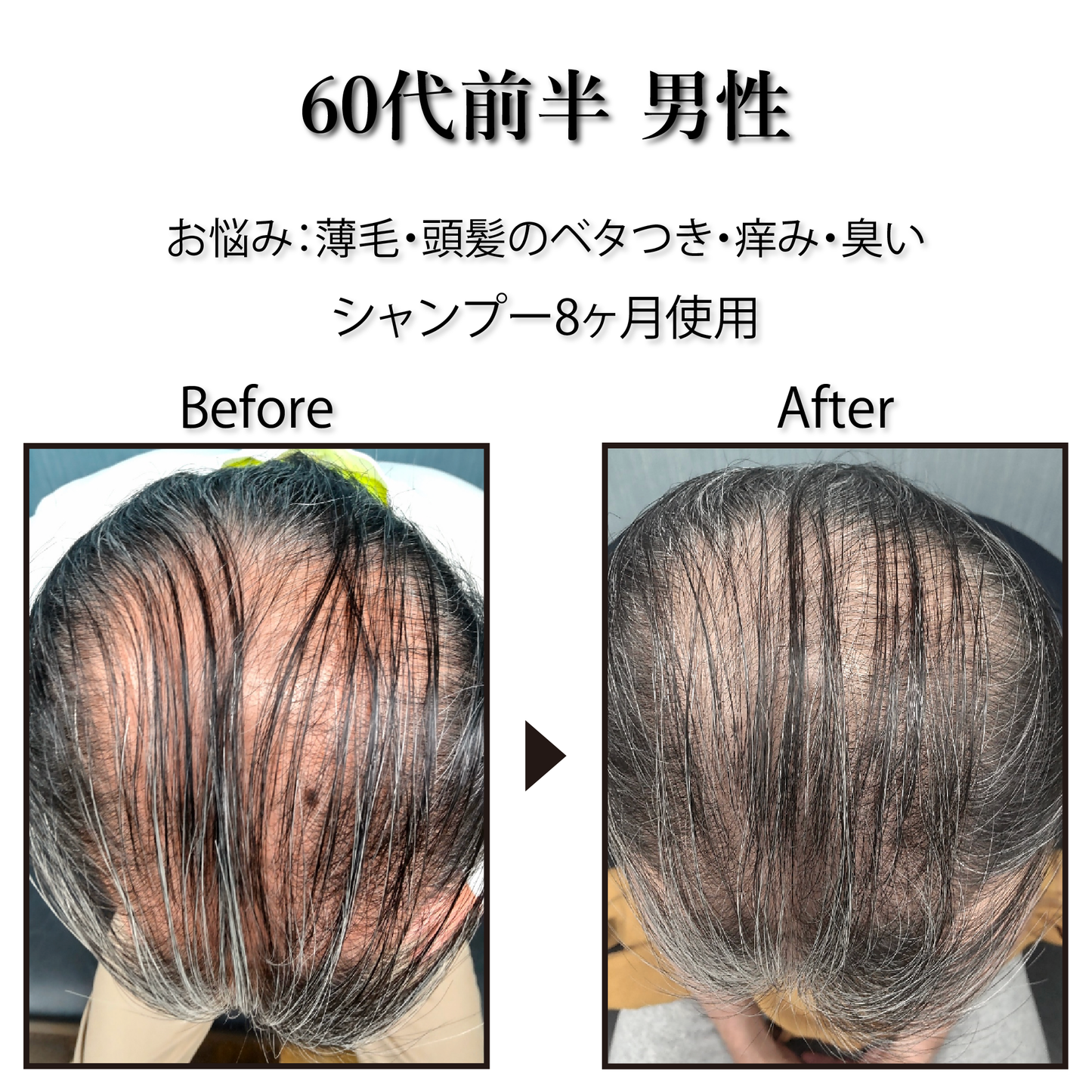 [Pro. Zero] Vital Herb Shampoo
